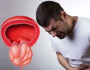 Simptomi kroničnog prostatitisa kod muškaraca